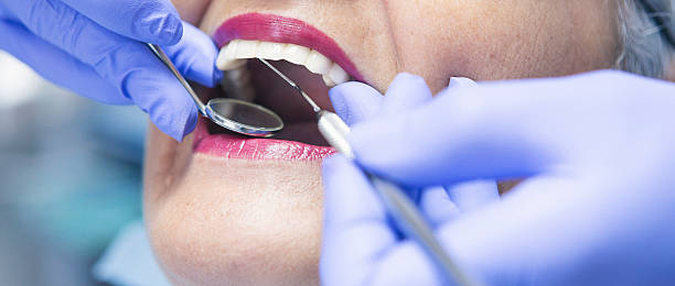 Best Lost Filling or Crown Replacement in Pierson, FL